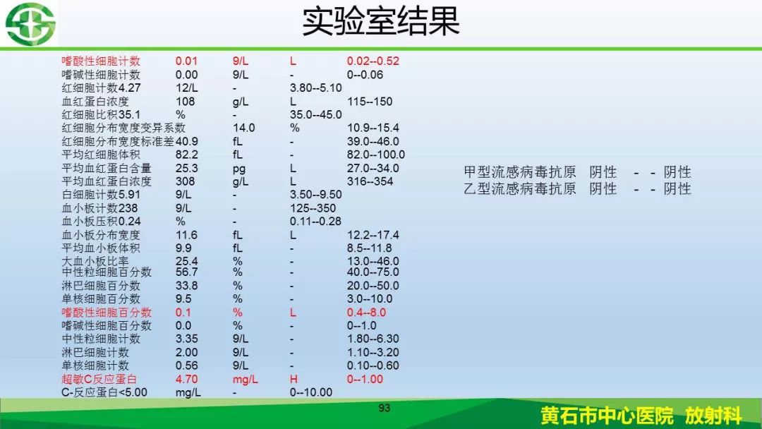 【PPT】新型冠状病毒（2019-nCoV）肺炎影像学表现病例分享