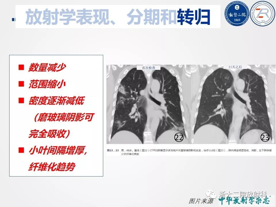 【PPT】新型冠状病毒肺炎影像学表现