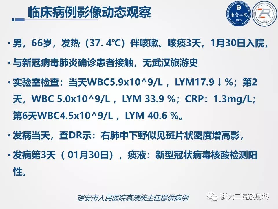 【PPT】新型冠状病毒肺炎影像学表现