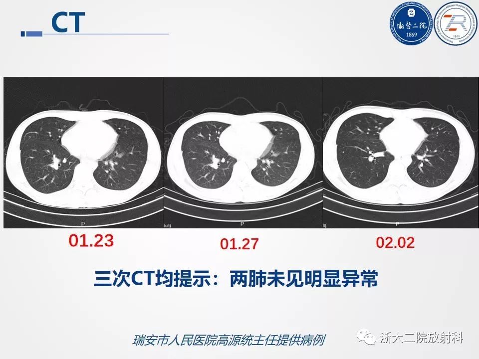 【PPT】新型冠状病毒肺炎影像学表现