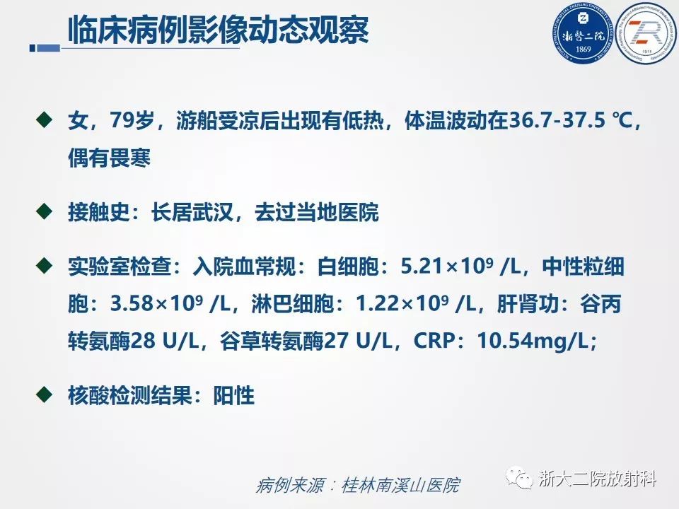 【PPT】新型冠状病毒肺炎影像学表现