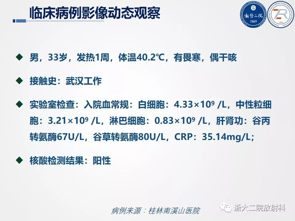 【PPT】新型冠状病毒肺炎影像学表现