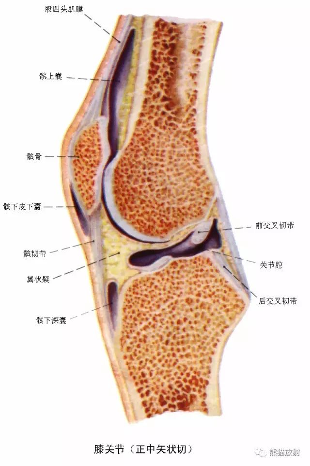 前交叉韧带损伤MRI 征象 前交叉韧带损伤MRI 征象