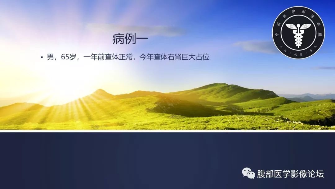 【病例】肾脏淋巴瘤1例CT影像