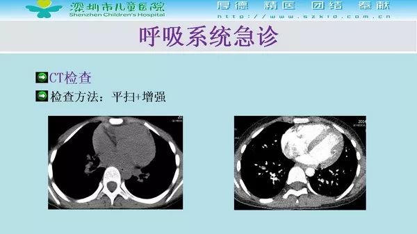 【PPT】影像检查在儿童急诊的应用价值