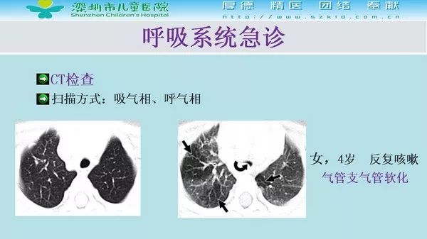 【PPT】影像检查在儿童急诊的应用价值
