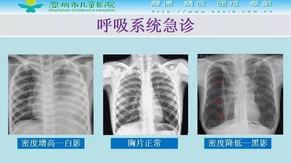 【PPT】影像检查在儿童急诊的应用价值