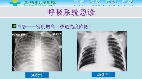 【PPT】影像检查在儿童急诊的应用价值