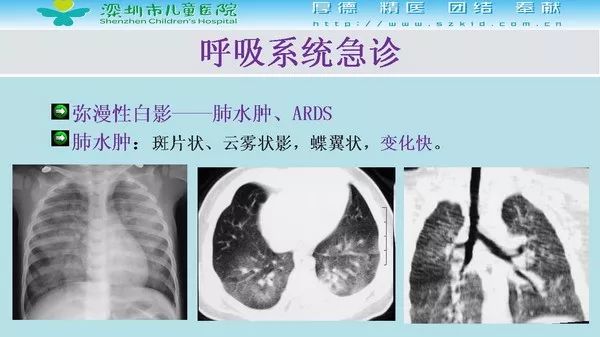 【PPT】影像检查在儿童急诊的应用价值