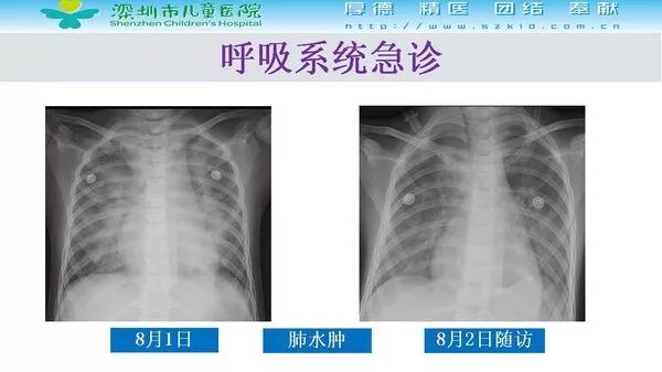 【PPT】影像检查在儿童急诊的应用价值