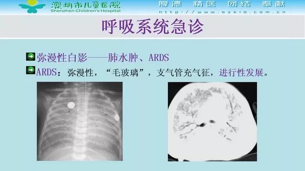 【PPT】影像检查在儿童急诊的应用价值