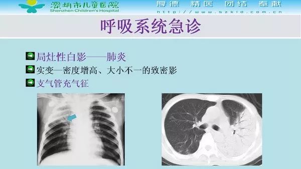 【PPT】影像检查在儿童急诊的应用价值