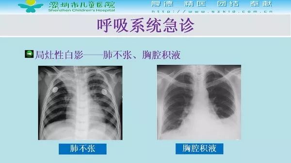 【PPT】影像检查在儿童急诊的应用价值