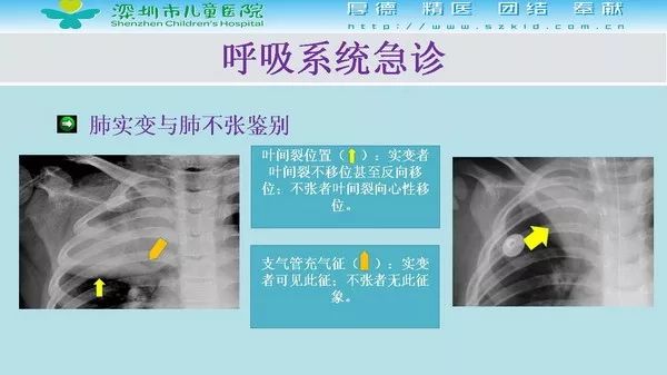 【PPT】影像检查在儿童急诊的应用价值