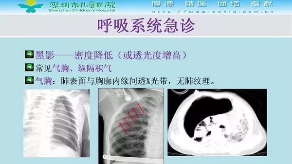 【PPT】影像检查在儿童急诊的应用价值