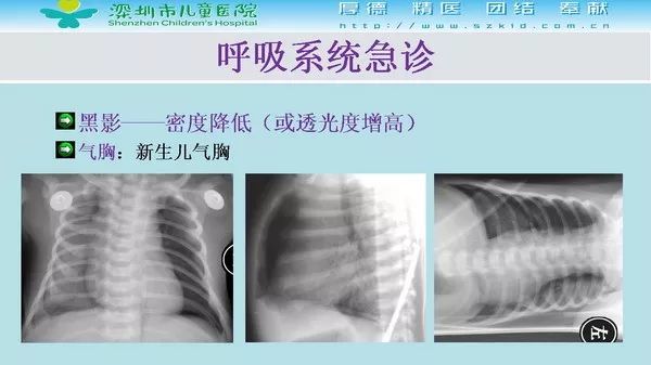 【PPT】影像检查在儿童急诊的应用价值