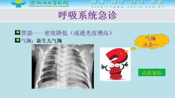【PPT】影像检查在儿童急诊的应用价值