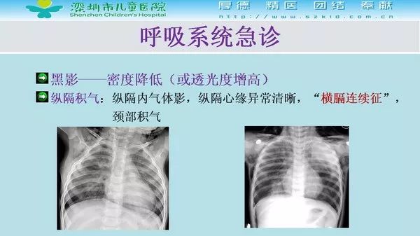 【PPT】影像检查在儿童急诊的应用价值