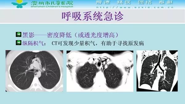 【PPT】影像检查在儿童急诊的应用价值
