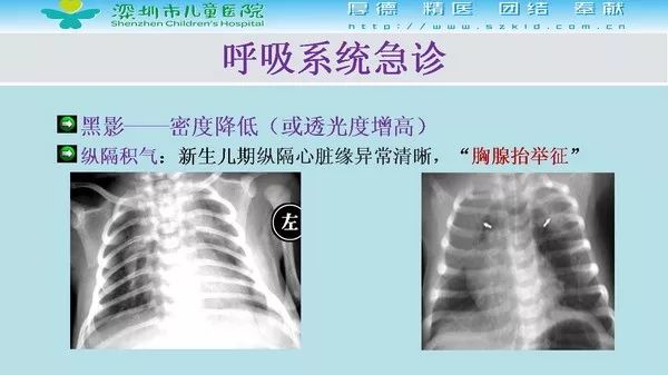 【PPT】影像检查在儿童急诊的应用价值