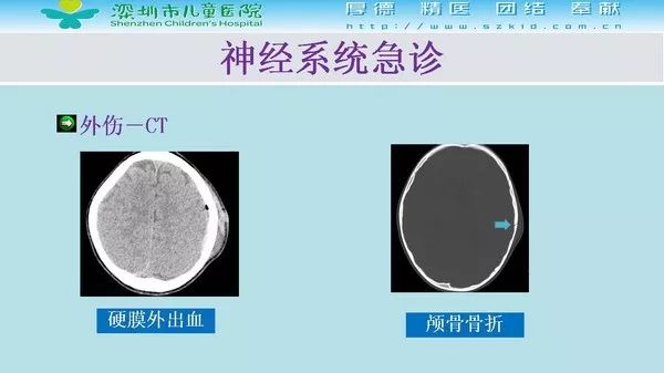 【PPT】影像检查在儿童急诊的应用价值