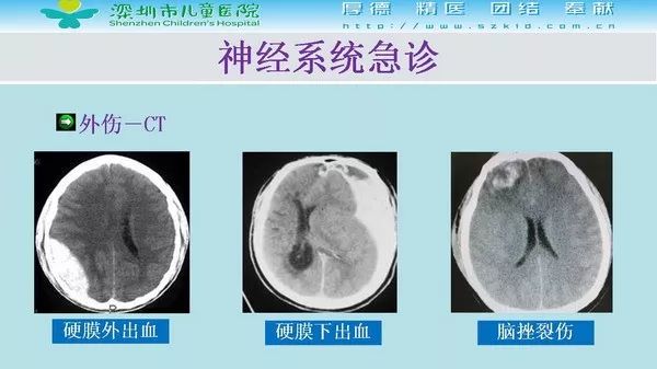 【PPT】影像检查在儿童急诊的应用价值