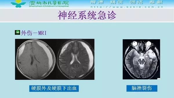 【PPT】影像检查在儿童急诊的应用价值