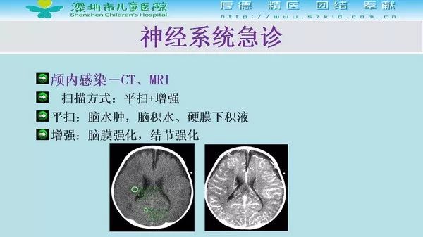 【PPT】影像检查在儿童急诊的应用价值