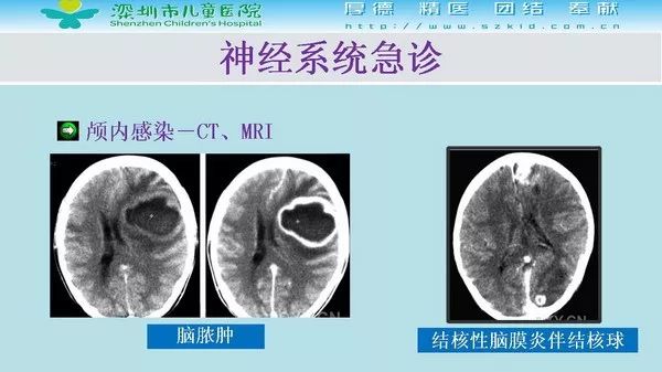 【PPT】影像检查在儿童急诊的应用价值