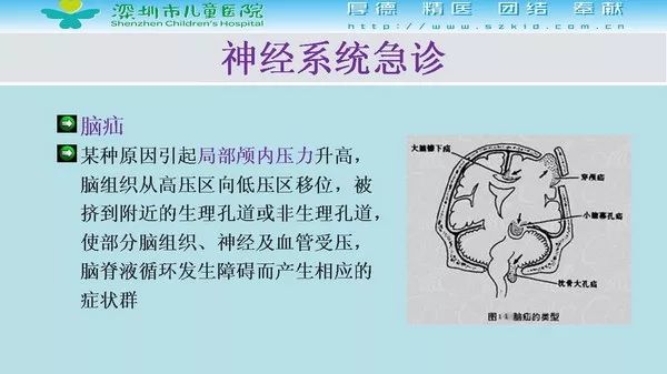 【PPT】影像检查在儿童急诊的应用价值