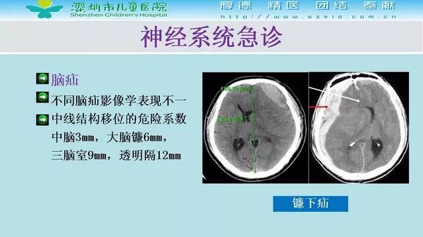 【PPT】影像检查在儿童急诊的应用价值