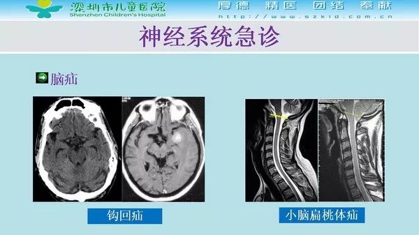 【PPT】影像检查在儿童急诊的应用价值