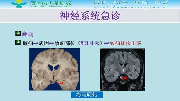 【PPT】影像检查在儿童急诊的应用价值