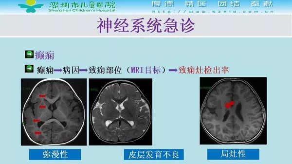 【PPT】影像检查在儿童急诊的应用价值