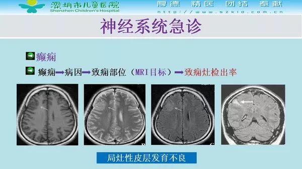 【PPT】影像检查在儿童急诊的应用价值