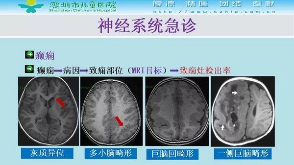 【PPT】影像检查在儿童急诊的应用价值