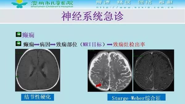 【PPT】影像检查在儿童急诊的应用价值