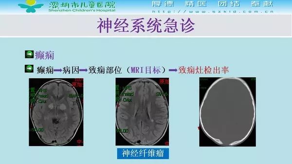 【PPT】影像检查在儿童急诊的应用价值