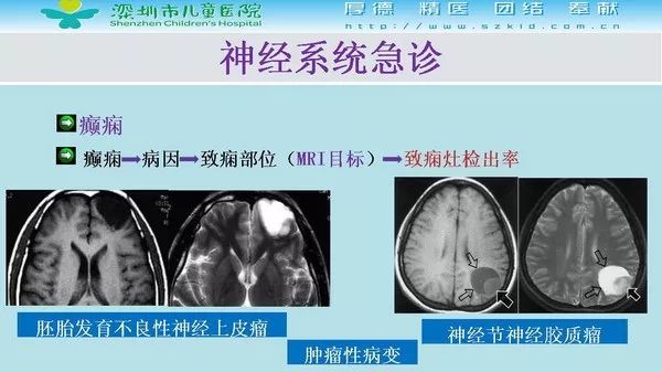 【PPT】影像检查在儿童急诊的应用价值