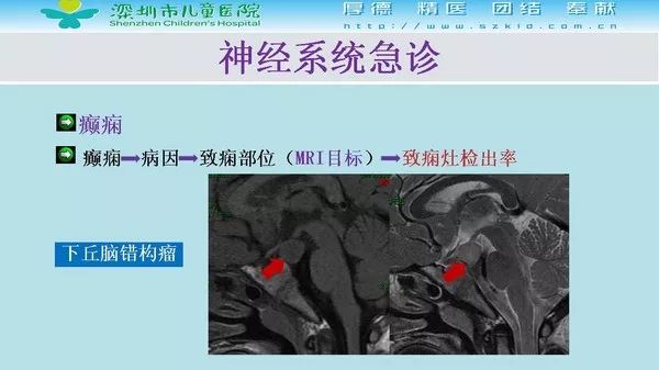 【PPT】影像检查在儿童急诊的应用价值