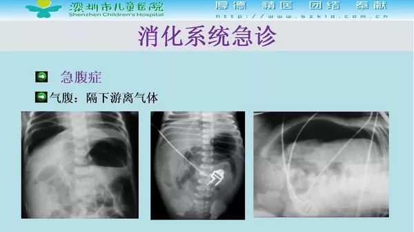 【PPT】影像检查在儿童急诊的应用价值