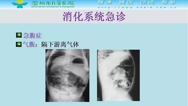 【PPT】影像检查在儿童急诊的应用价值
