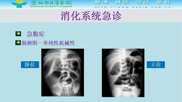 【PPT】影像检查在儿童急诊的应用价值
