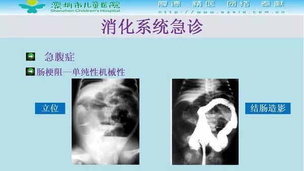【PPT】影像检查在儿童急诊的应用价值