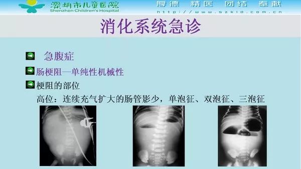 【PPT】影像检查在儿童急诊的应用价值
