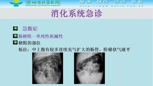【PPT】影像检查在儿童急诊的应用价值