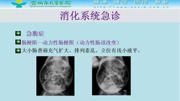 【PPT】影像检查在儿童急诊的应用价值