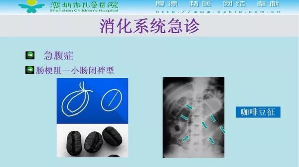 【PPT】影像检查在儿童急诊的应用价值