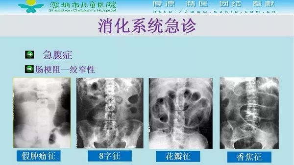 【PPT】影像检查在儿童急诊的应用价值