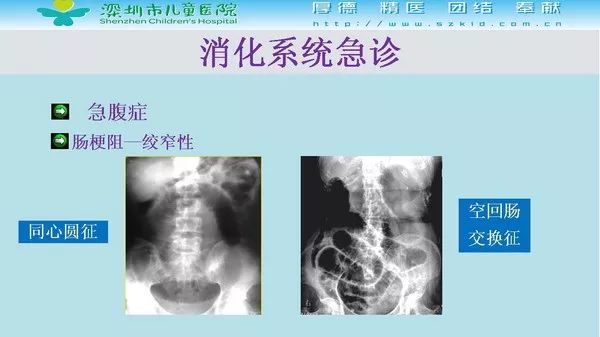 【PPT】影像检查在儿童急诊的应用价值